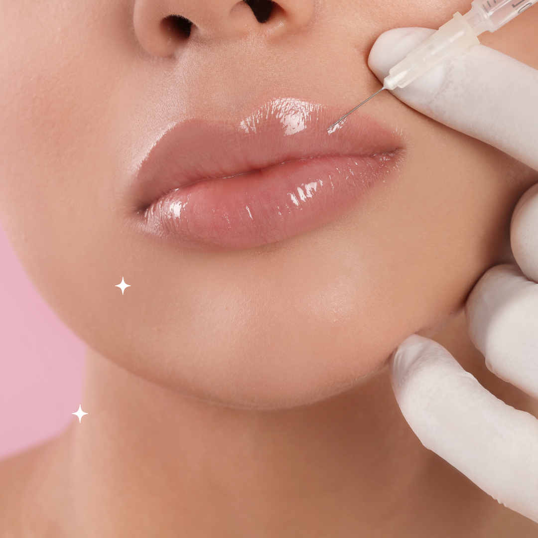 Preenchimento Labial