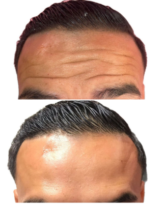 2 4